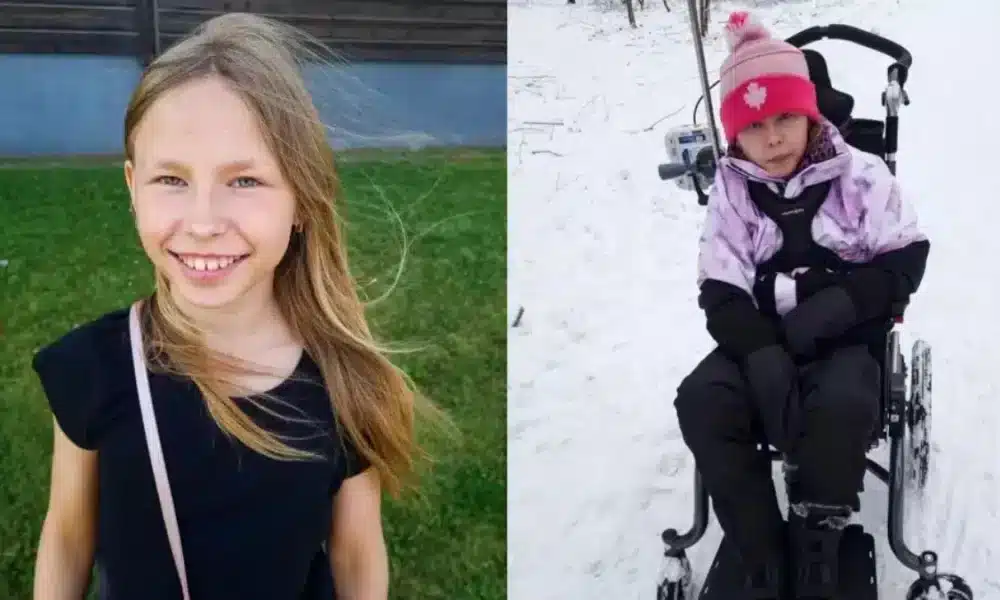 Luna antes y después de sufrir el ataque de Abushi Shamse Kamal. Instagram